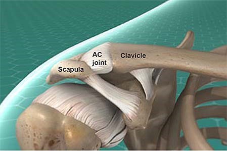 Acromioclavicular Joint Fixation - Dr Lingaraju